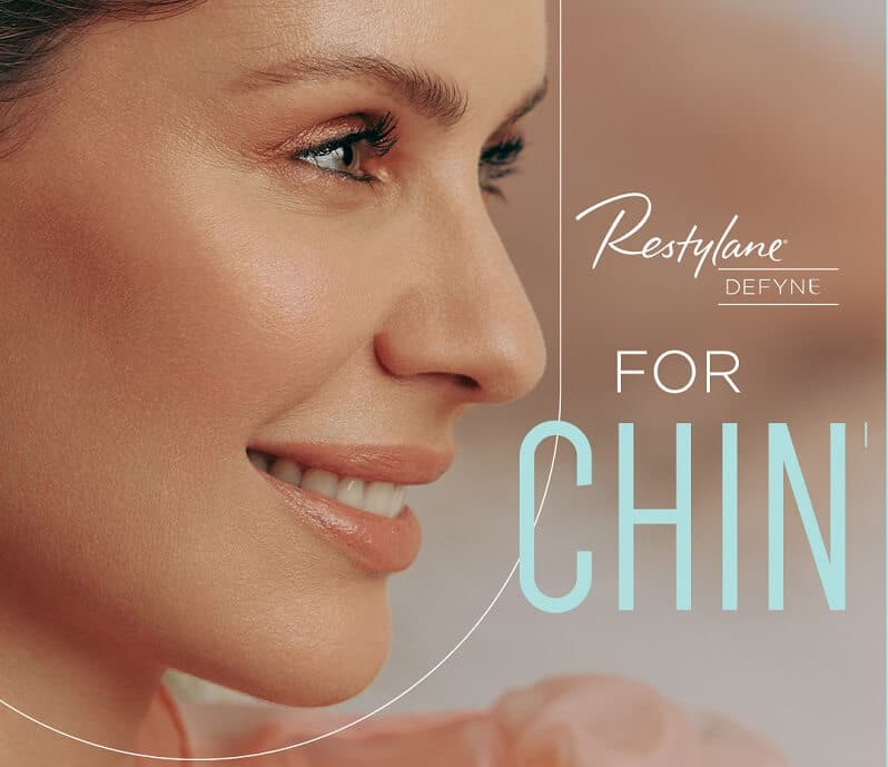 restylane defyne for the chin 1