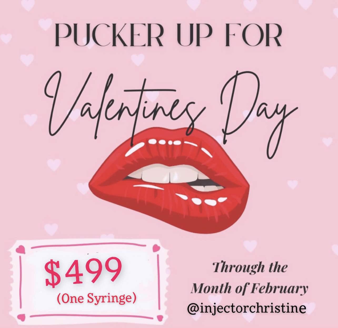 $499 Lip Filler Promotion Fairfax VA - Valentines Day Lip Injection Promo