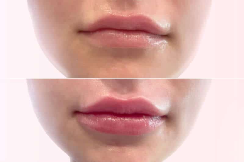 lip pout image 1